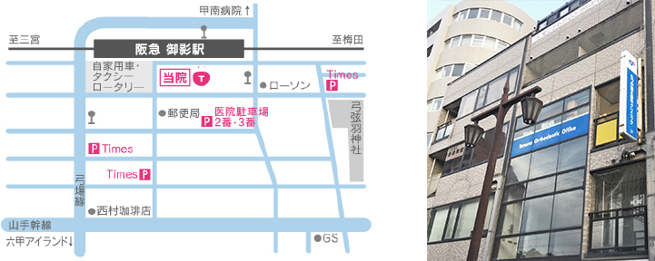 アクセス 御影 たつの矯正歯科クリニック 神戸市東灘区 阪急神戸線 御影駅前